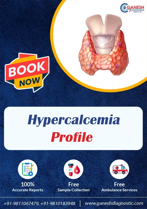 Hypercalcemia Profile